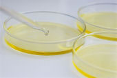 Petri Dishes